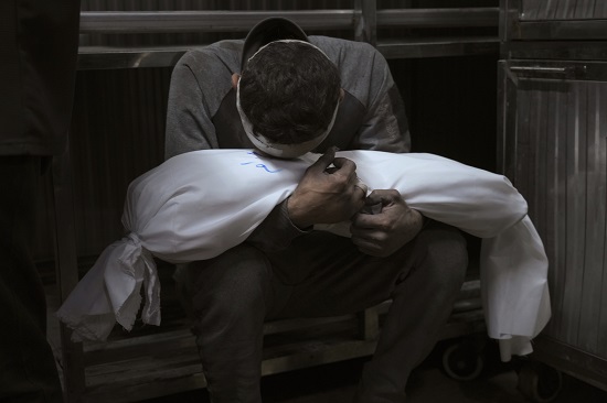Gazans malnourished